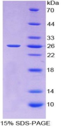 SDS PAGE (TIMP3-545H).jpg